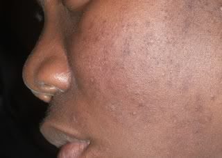 obagiday7left-6622765